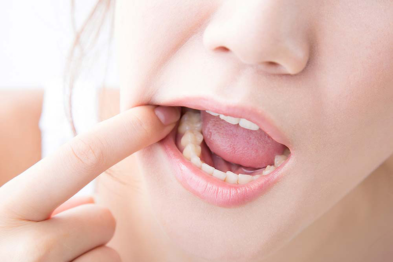 むし歯は「痛くなる前」の早期治療を