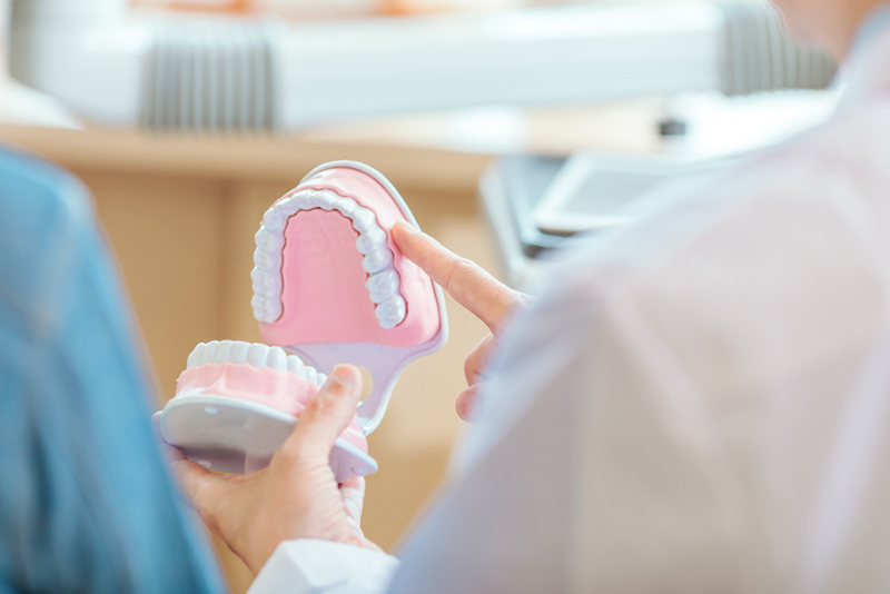 インプラントを守るためのメンテナンス