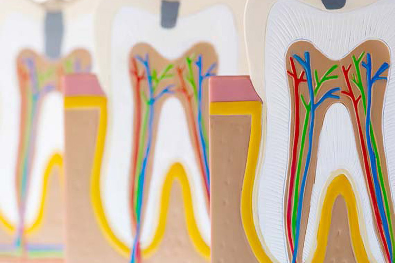 歯の根の中にある「根管」とは
