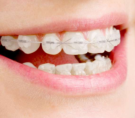 矯正歯科・小児矯正歯科