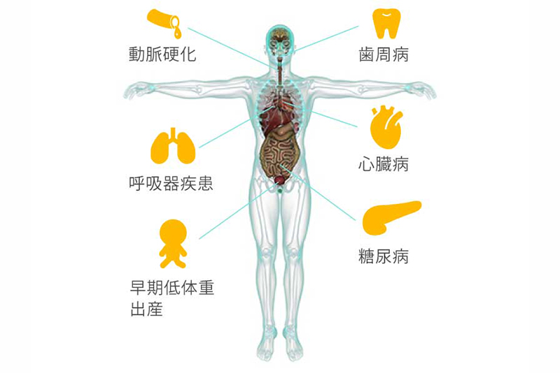 歯周病と全身の健康との関係