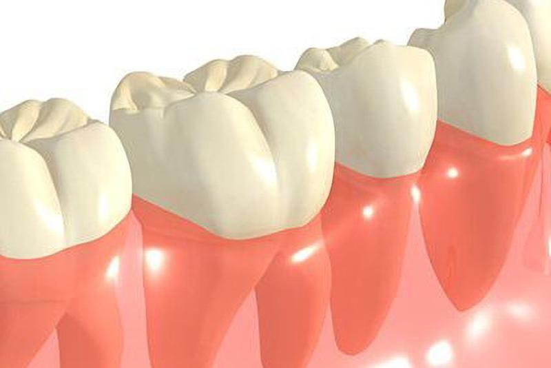 歯周病が進行する原因