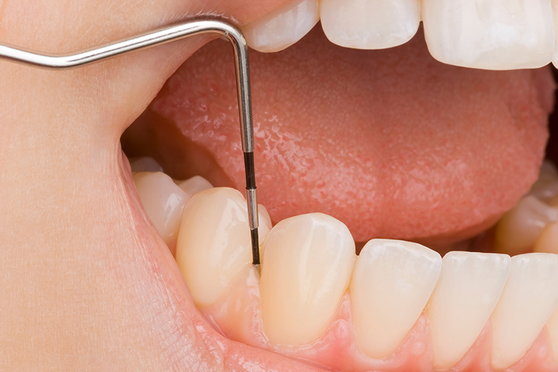 お口の状態を把握するための検査