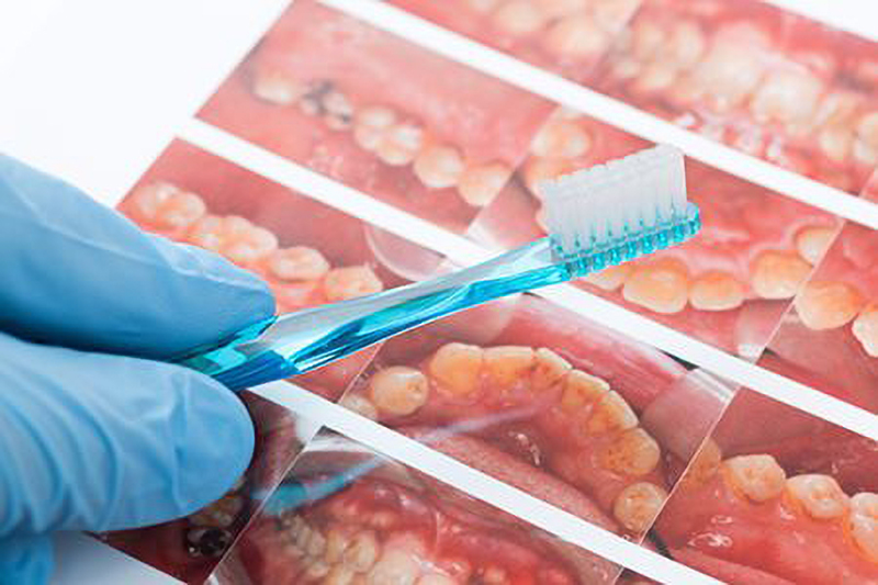 再発を防ぐためのメンテナンス