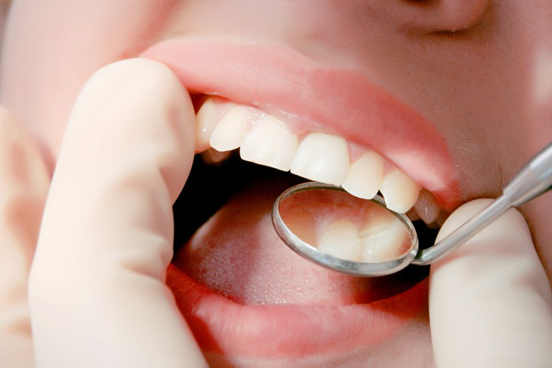 お口の状態チェック